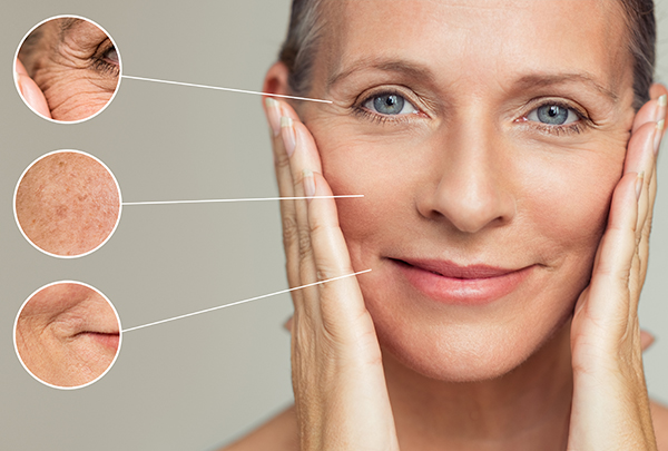 Anti Wrinkles Procedure in Reno